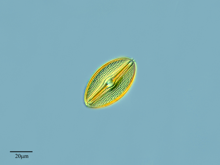 Представитель Семейства Diploneidaceae